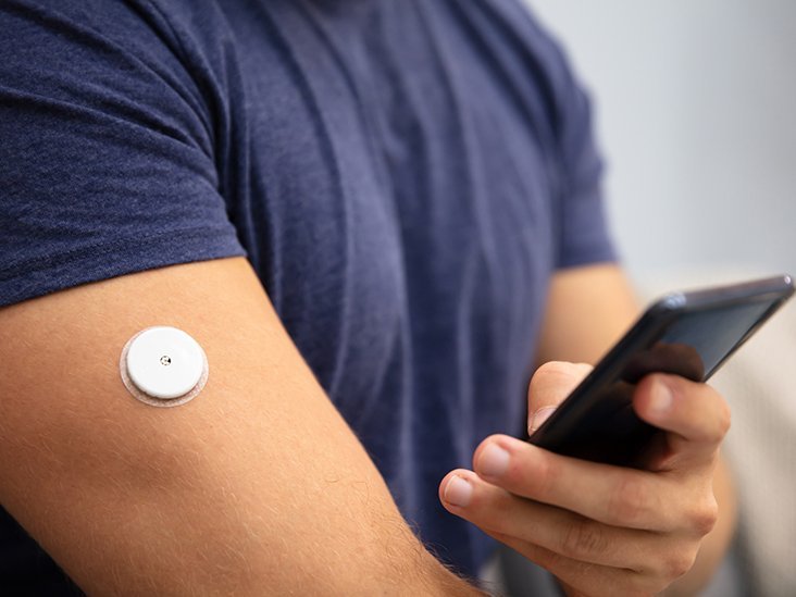 CGM Data in a Diet Controlled Diabetic